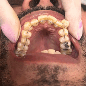 8